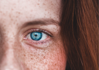 Why you shouldn’t rub your eyes!