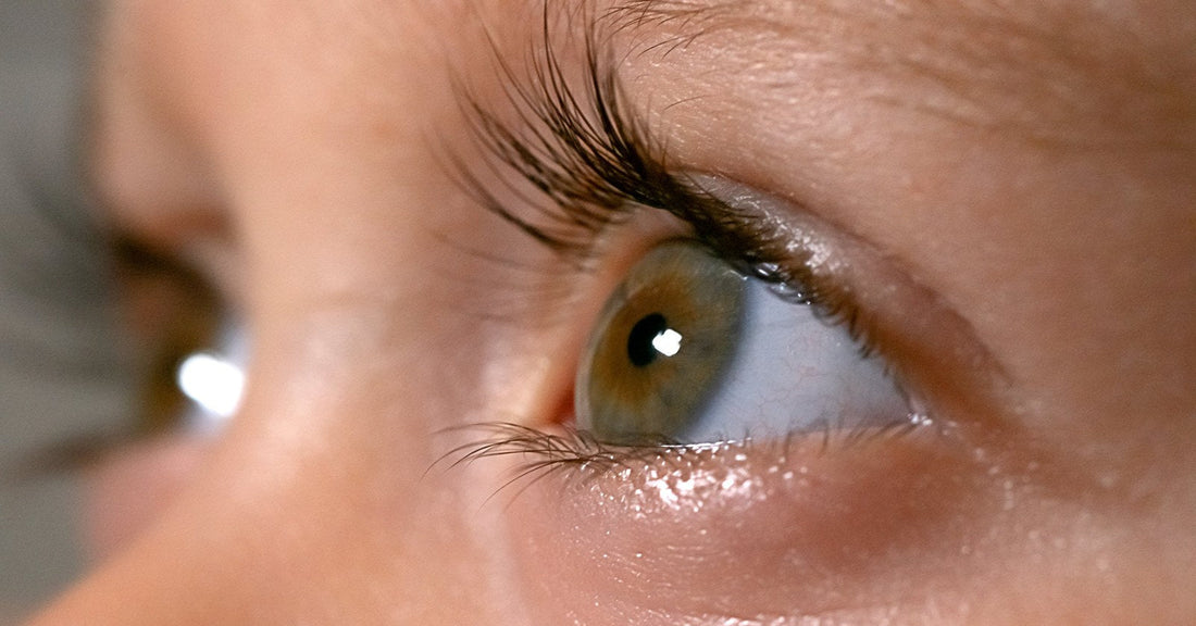 Puffy Eyes After Crying: Why It Happens and How to Recover