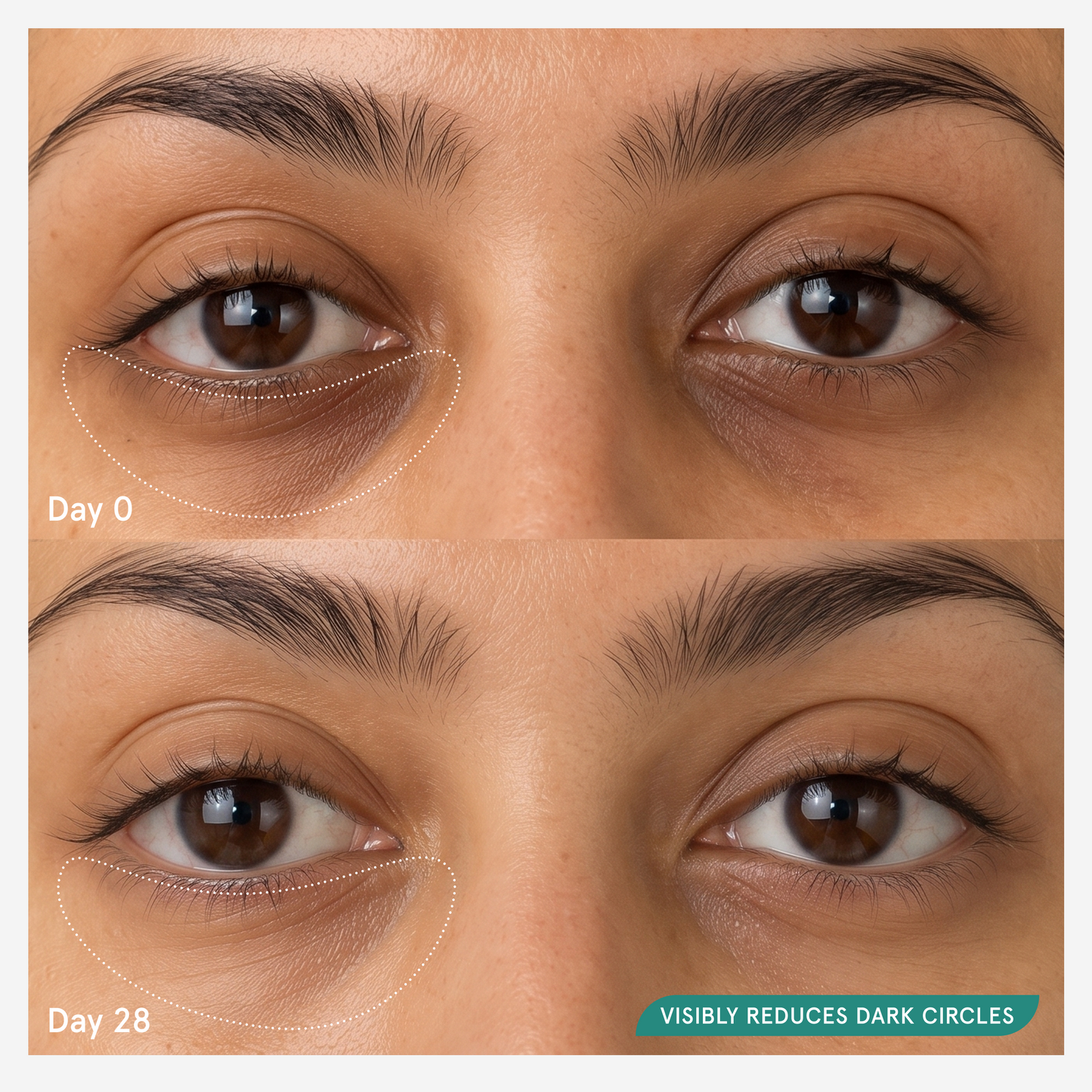 Before and after comparison at day 0 and day 28
