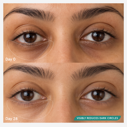 Before and after comparison at day 0 and day 28